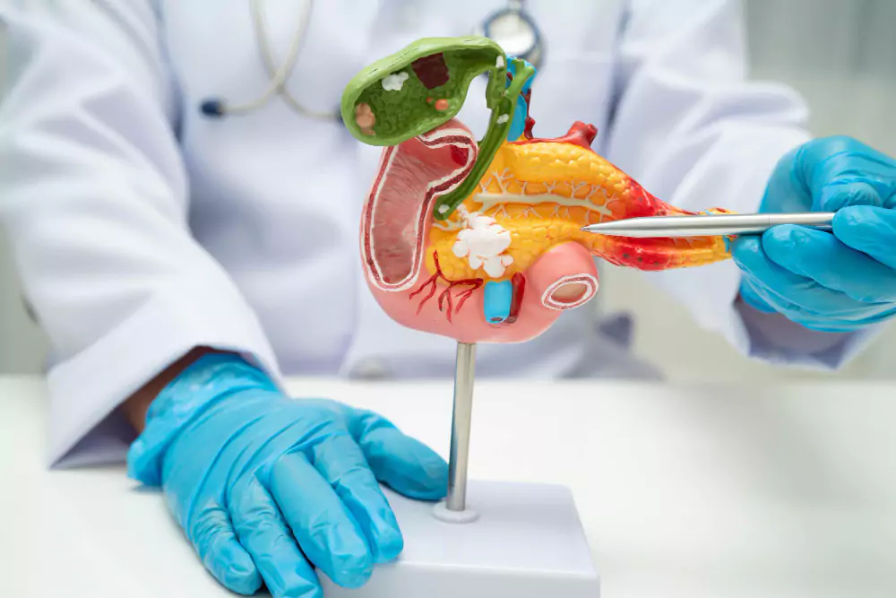 Gall Bladder Stone Surgery
