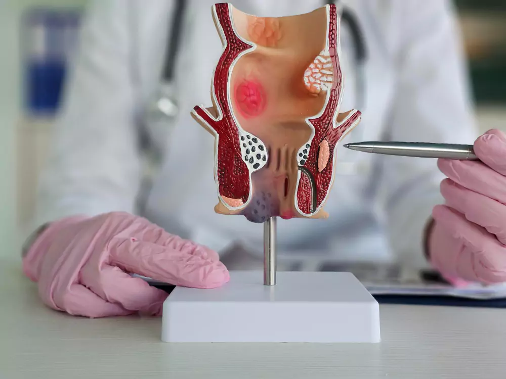 Proctology Surgery